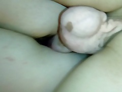 My balls in Vitiligo,,pierced albert